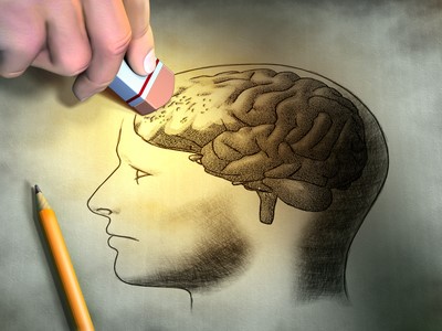 A drawing of a human brain